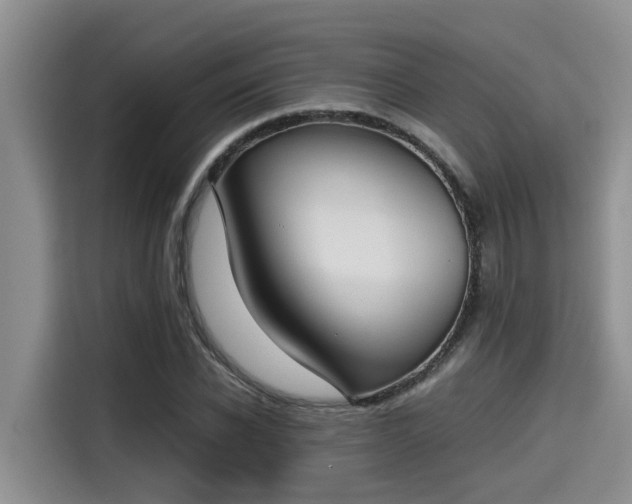 X0000115600926200911171125