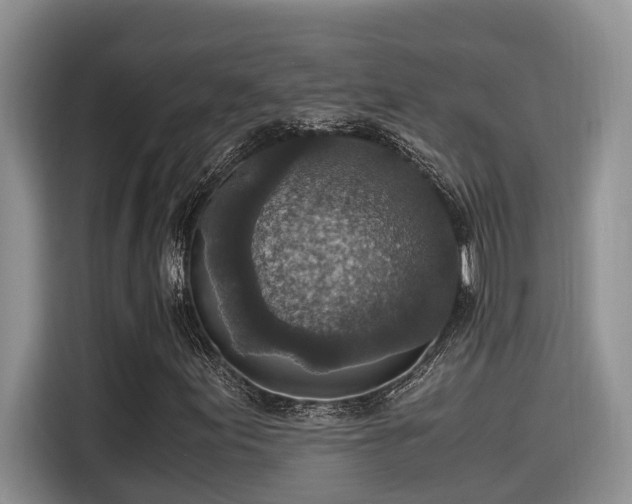 X0000115601155200911171122