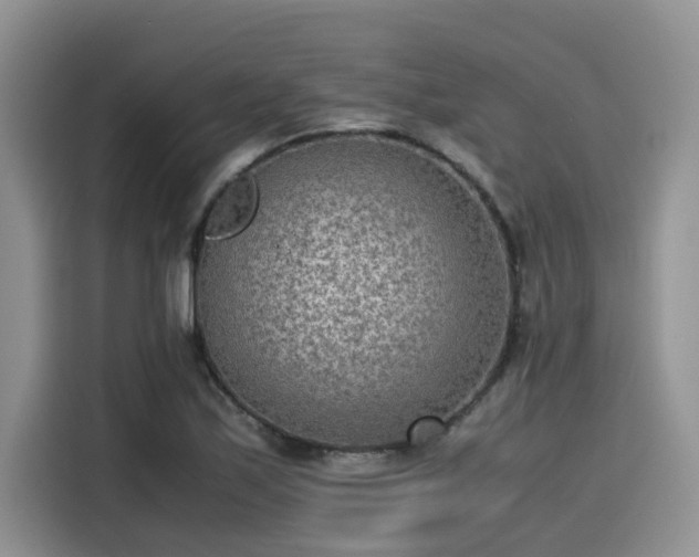 X0000115601171200911171122