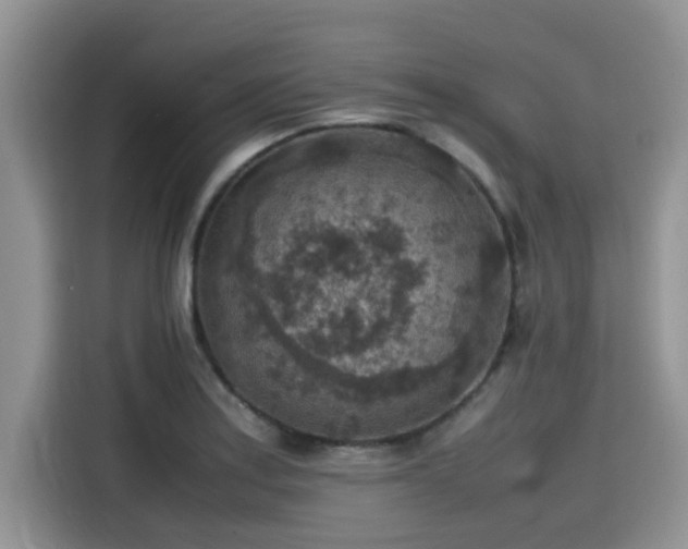 X0000115601179200911171122