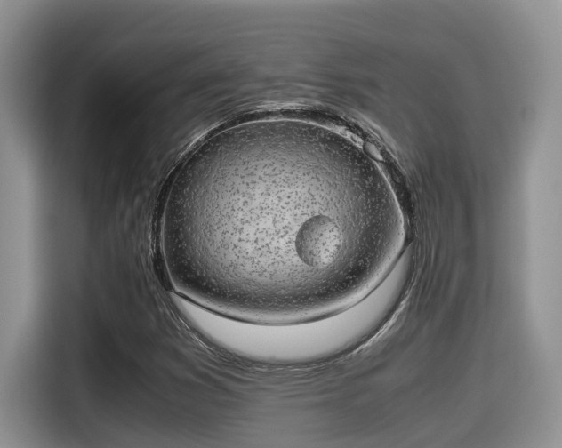 X0000115601353200911171120