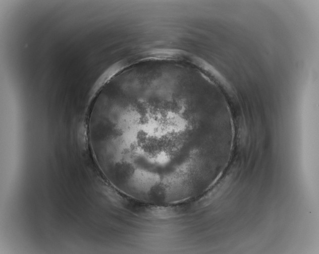 X0000115601362200911171120