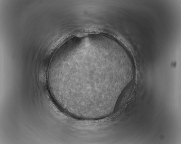 X0000115600009200912011537