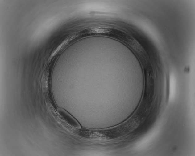 X0000115600387200912011531