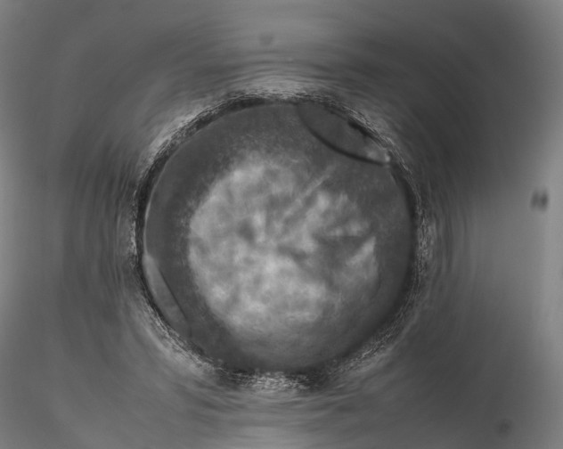 X0000115600399200912011531