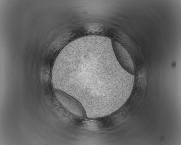 X0000115600417200912011531