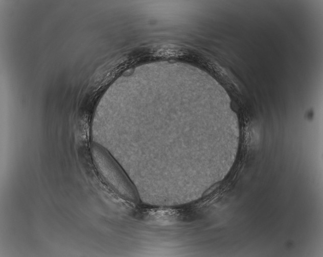 X0000115600517200912011529