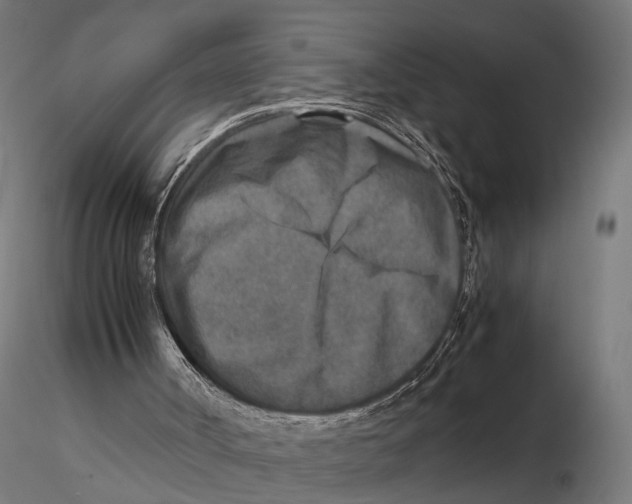 X0000115600002200912081124