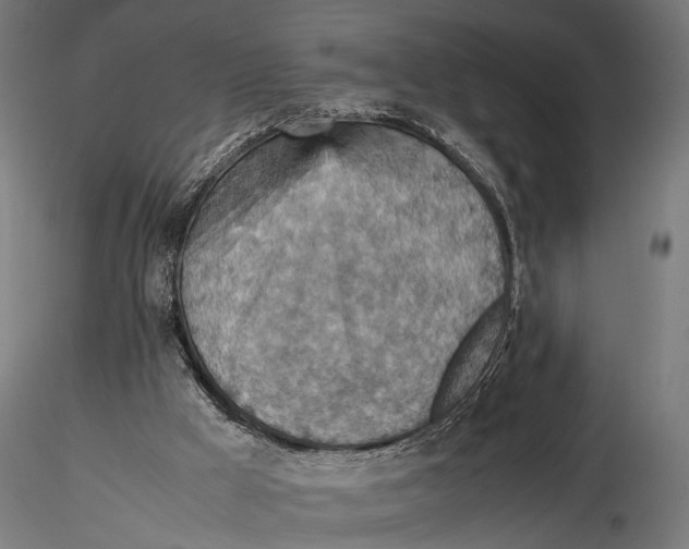 X0000115600009200912081124