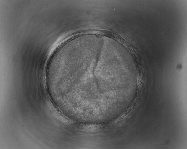 X0000115600198200912081121