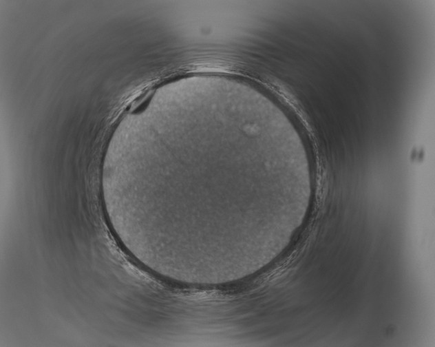 X0000115600385200912081118