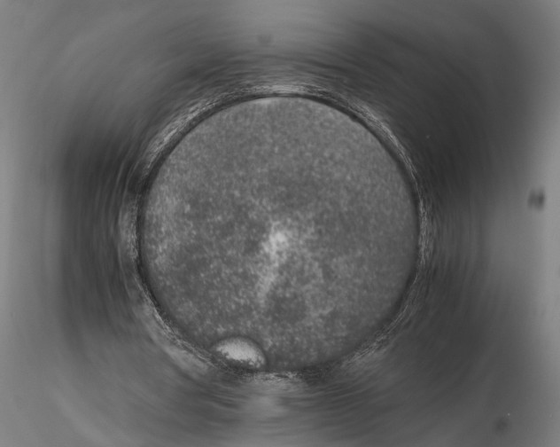 X0000115600386200912081118