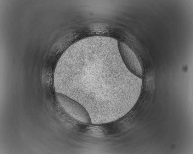 X0000115600417200912081118