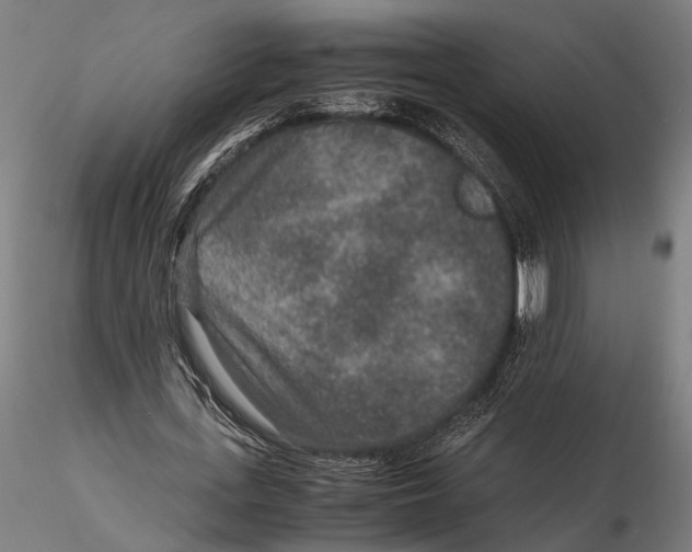 X0000115600723200912081113