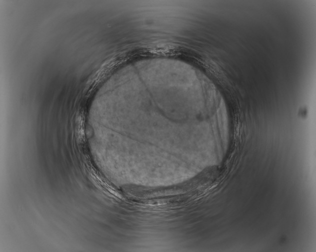 X0000115601106200912081107