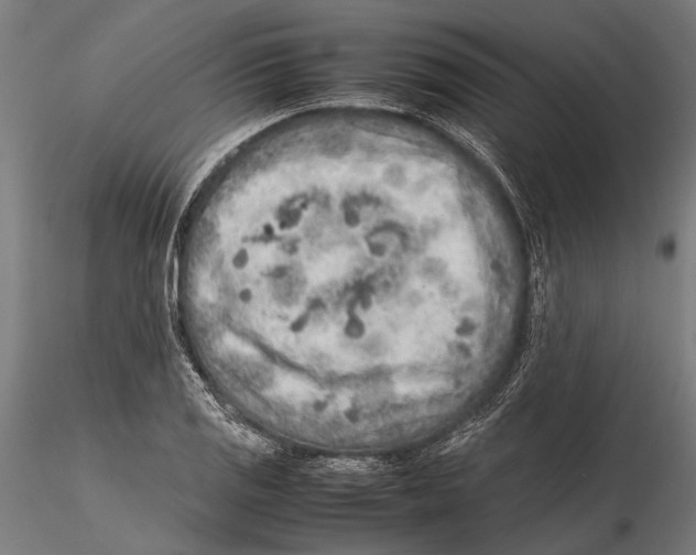 X0000115601125200912081107