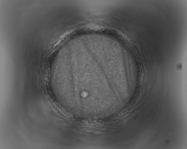 X0000115601397200912081102