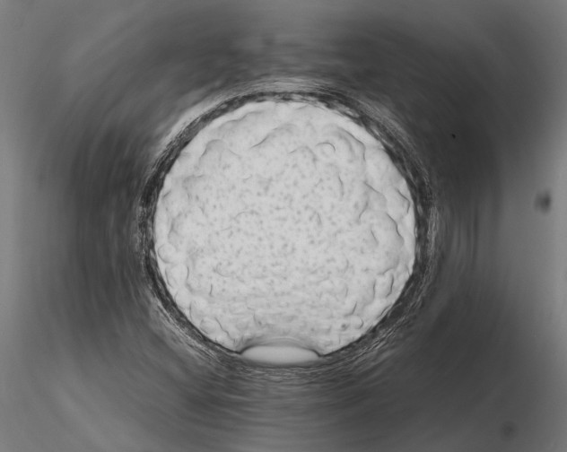 X0000115601404200912081102