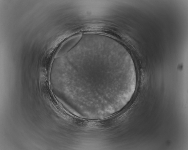 X0000115601449200912081102