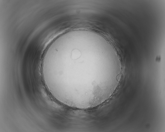 X0000115600146200912221153