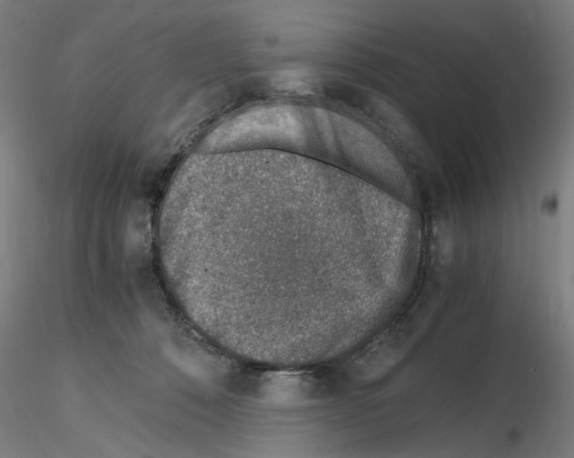 X0000115600320200912221151