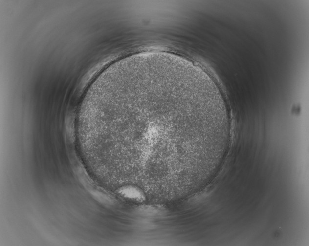 X0000115600386200912221151