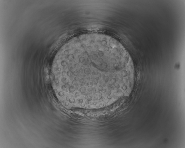 X0000115601106200912221140