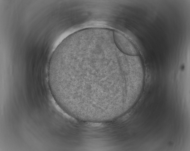 X0000115601382200912221137