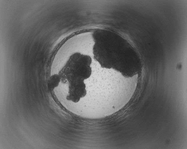 X0000115601404200912221136