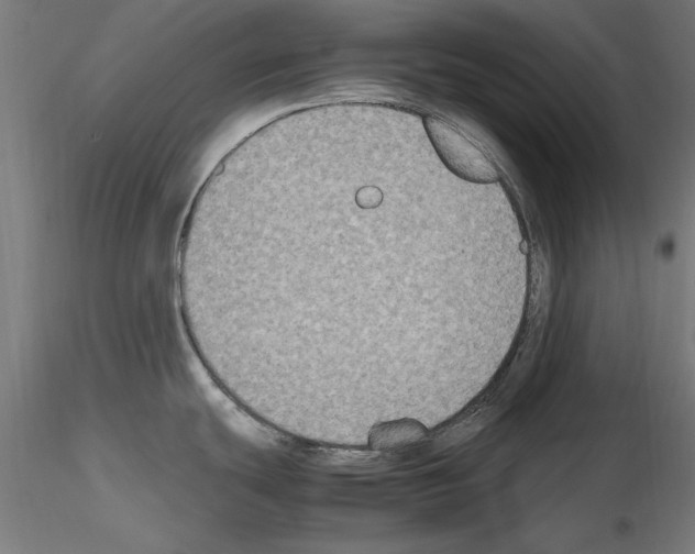 X0000115601439200912221137