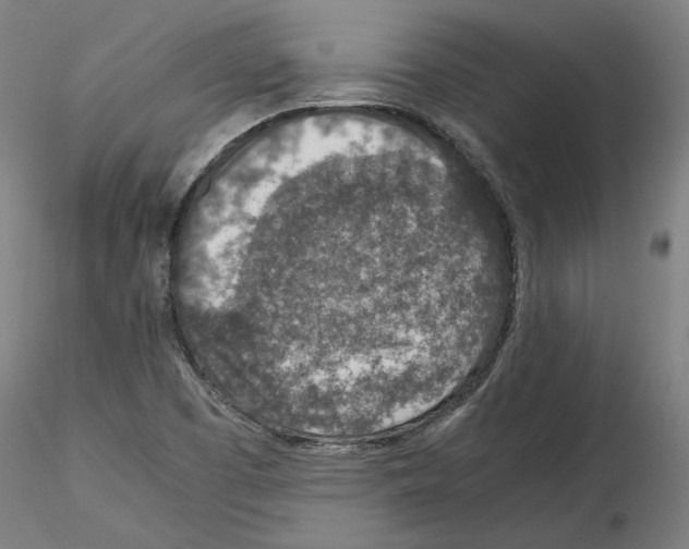 X0000115601457200912221136