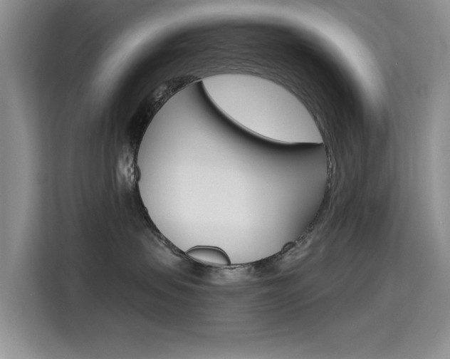 X0000115610479200911100935