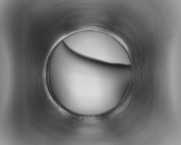 X0000115611007200911100928
