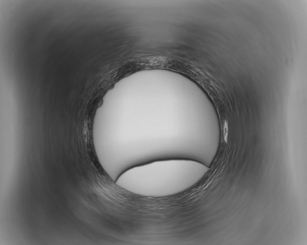 X0000115611395200911100922