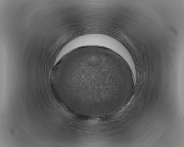 X0000115610124200911101435