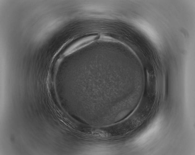 X0000115610387200911101431