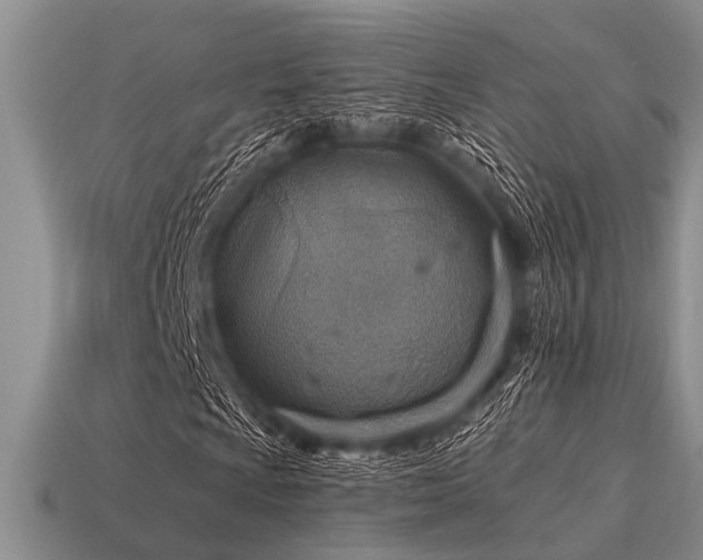 X0000115611009200911101422
