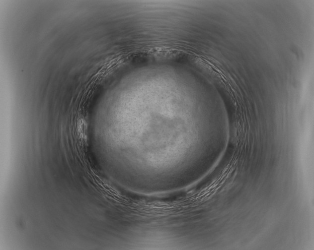 X0000115611010200911101422