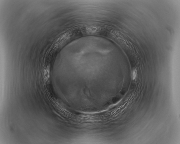 X0000115611011200911101422