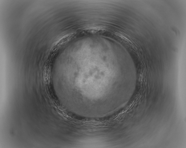 X0000115611014200911101422