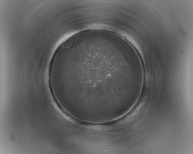 X0000115611045200911101423