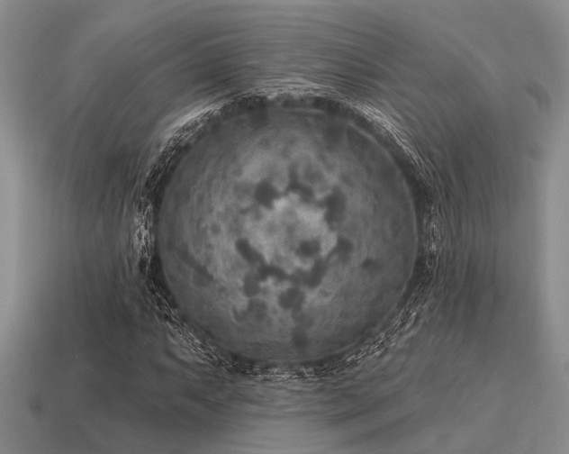 X0000115611063200911101422