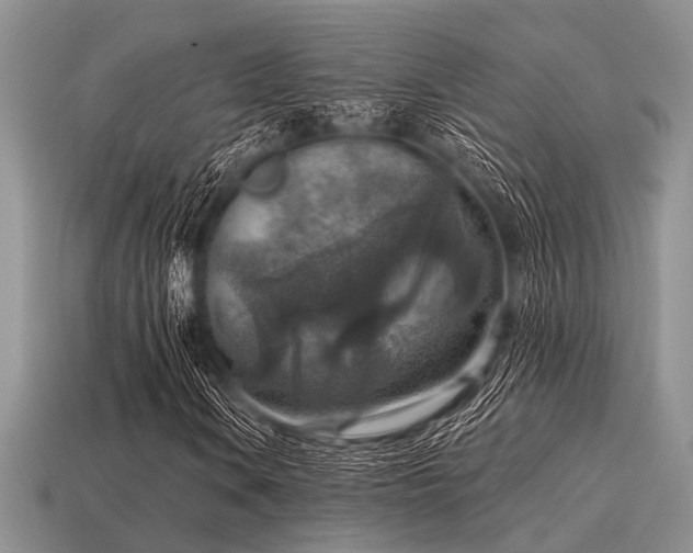 X0000115611106200911101421