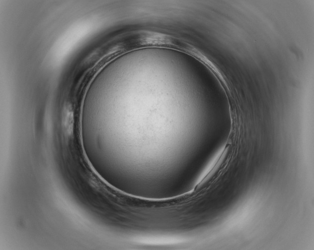 X0000115611151200911101422
