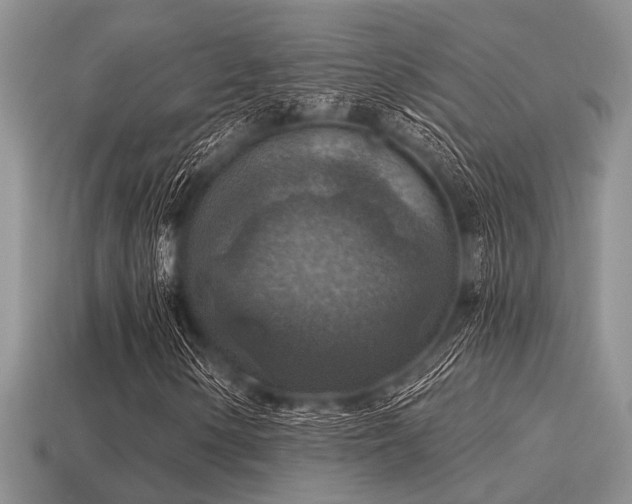 X0000115611154200911101421