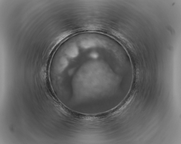 X0000115611170200911101421
