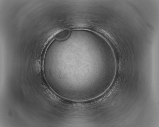 X0000115611212200911101420
