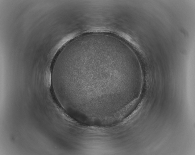 X0000115611221200911101420