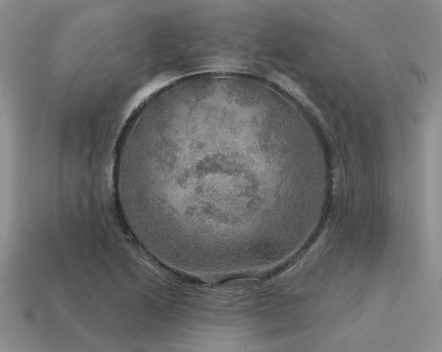 X0000115611222200911101420