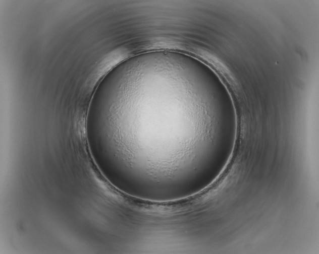 X0000115611241200911101420